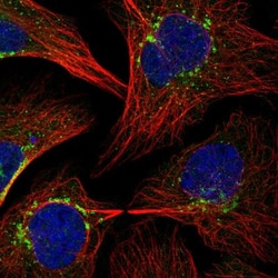 beta COP Antibody, Novus Biologicals 25 &mu;L, Unlabeled:Antibodies, Polyclonal